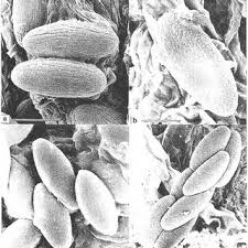 Attēlu rezultāti vaicājumam “Ophiostoma polyporicola”