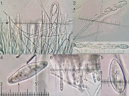 Attēlu rezultāti vaicājumam “Lachnellula willkommii”