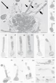 Attēlu rezultāti vaicājumam “Badhamiopsis scripta spores”