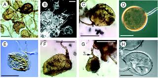 Attēlu rezultāti vaicājumam “Oligonema flavidum spores”