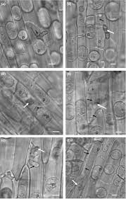 Attēlu rezultāti vaicājumam “Dianema depressum spores”