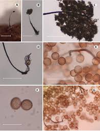 Attēlu rezultāti vaicājumam “Comatricha nigra spores”
