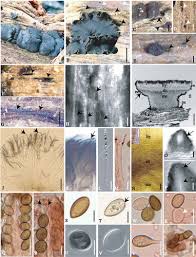 Attēlu rezultāti vaicājumam “Ombrophila violacea spores”