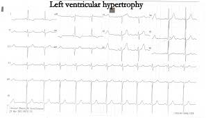 Image result for  ^ L V [ h    