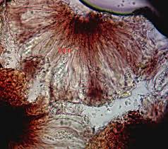 Attēlu rezultāti vaicājumam “Bilimbia tetramera”