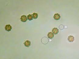 Attēlu rezultāti vaicājumam “Reticularia lycoperdon spores”