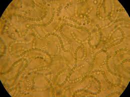 Attēlu rezultāti vaicājumam “Nostoc commune macro”