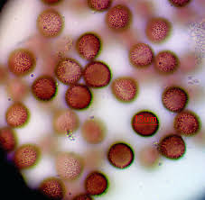 Attēlu rezultāti vaicājumam “Badhamia capsulifera var. arborea sessile”