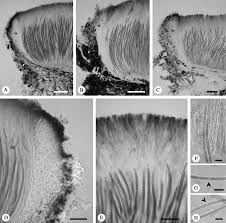 Attēlu rezultāti vaicājumam “Stictis”