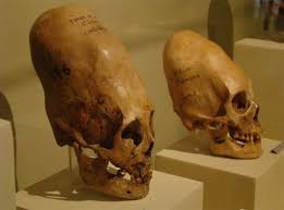 Image result for elongated skulls