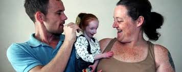 Image result for Nanismo Primordial