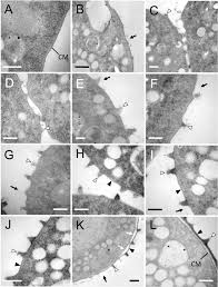Attēlu rezultāti vaicājumam “Trichia alpina sessile”