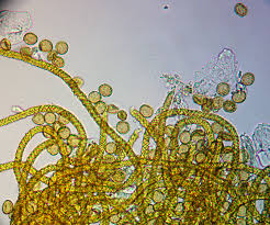 Attēlu rezultāti vaicājumam “Trichia longipalpis spores”