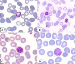 Attēlu rezultāti vaicājumam “Siphoptychium violaceum plasmodium”