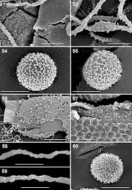 Attēlu rezultāti vaicājumam “Perichaena depressa spores”