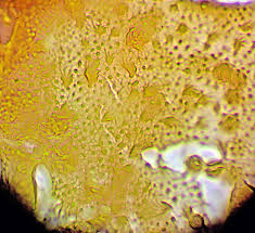 Attēlu rezultāti vaicājumam “Arcyria affinis young”