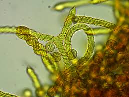 Attēlu rezultāti vaicājumam “Trichia scabra spores”