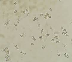 Attēlu rezultāti vaicājumam “Badhamia lilacina young”