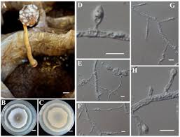 Attēlu rezultāti vaicājumam “Fuligo gyrosa spores”