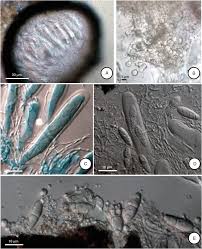 Attēlu rezultāti vaicājumam “Lichenoconium xanthoriae”