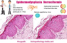 Image result for Lewandowsky-Lutz