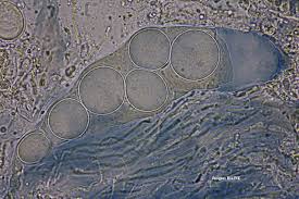 Attēlu rezultāti vaicājumam “Trichia contorta spores”