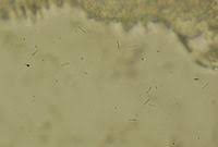 Attēlu rezultāti vaicājumam “Hyalorbilia inflatula”