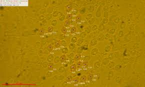 Attēlu rezultāti vaicājumam “Mucronella calva”