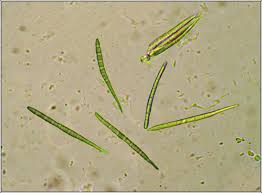 Attēlu rezultāti vaicājumam “Bacidia rubella”