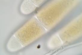 Attēlu rezultāti vaicājumam “Bactridium flavum”