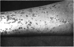 Image result for Lewandowsky-Lutz