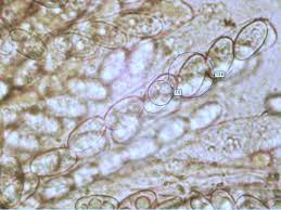 Attēlu rezultāti vaicājumam “Ombrophila violacea spores”