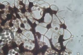 Attēlu rezultāti vaicājumam “Cribraria microcarpa”