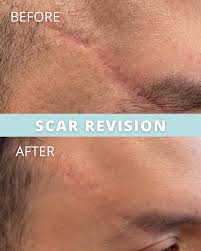 Image result for rupaljanuj