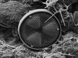 Attēlu rezultāti vaicājumam “Arcyria stipata spores”