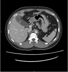 Image result for Phrygian cap