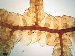 Attēlu rezultāti vaicājumam “Frullania fragilifolia macro”