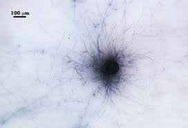 Attēlu rezultāti vaicājumam “Enteridium liceoides spores”