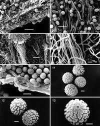 Attēlu rezultāti vaicājumam “Amaurochaete fusiformis spores”