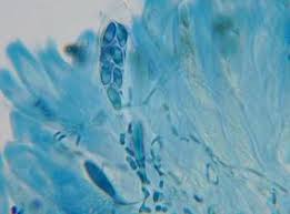 Attēlu rezultāti vaicājumam “Xylographa paralella”