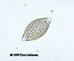 Attēlu rezultāti vaicājumam “Trichia longipalpis spores”
