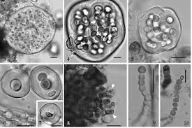 Attēlu rezultāti vaicājumam “Nostoc commune cells”