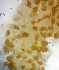 Attēlu rezultāti vaicājumam “Lycogala ustulatum sessile”