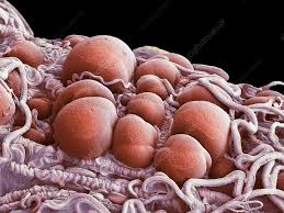 Attēlu rezultāti vaicājumam “Diachea muscorum plasmodium”