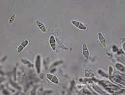 Attēlu rezultāti vaicājumam “Cliostomum corrugatum”