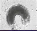 Endoparasitoid