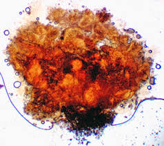 Attēlu rezultāti vaicājumam “Lycogala ustulatum sessile”