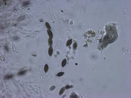 Attēlu rezultāti vaicājumam “Diderma simplex spores”