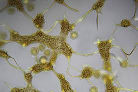 Attēlu rezultāti vaicājumam “Cribraria cancellata var. fusca spores”