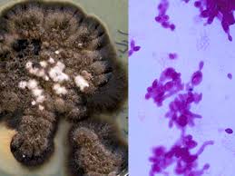 Attēlu rezultāti vaicājumam “Schistidium dupretii sporophyte”